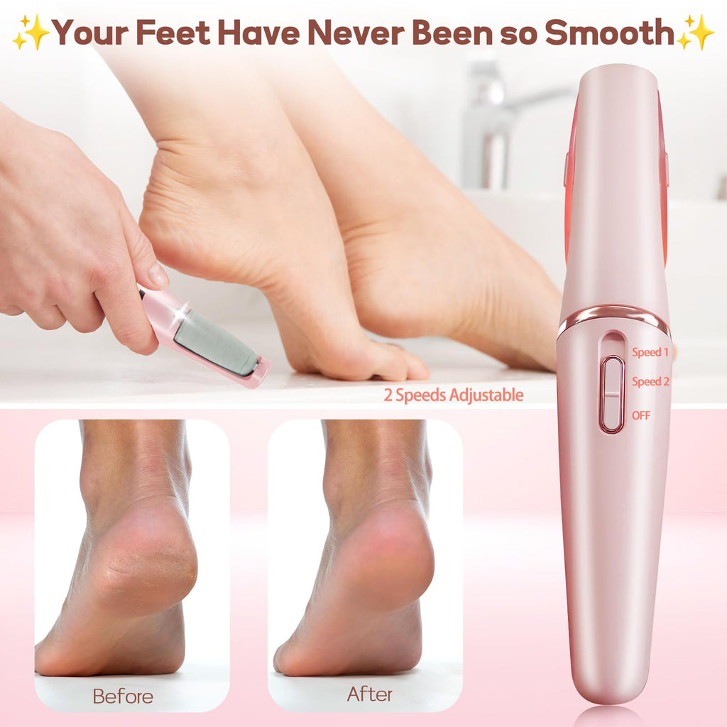Electric Foot Grinder Pedicure Machine – Remove Dead Skin & Calluses | USB Rechargeable