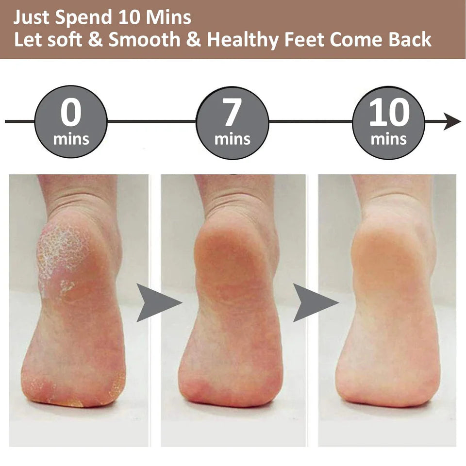 🔥 Buy 1 Get 1 FREE – Electric Foot Callus Remover 👣✨ (UAE Exclusive Offer)