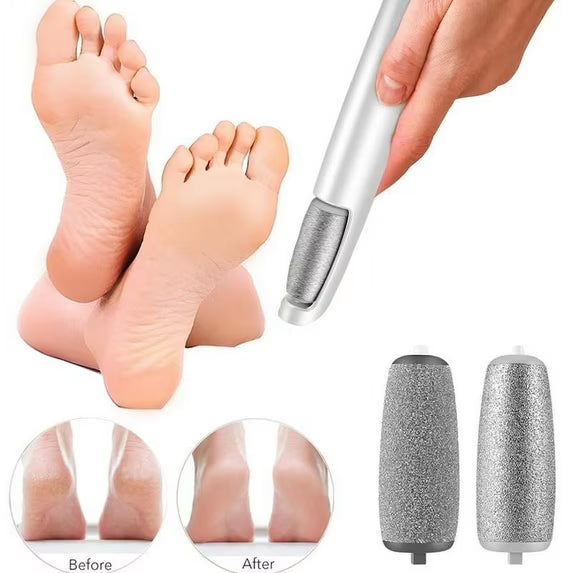 🔥 Buy 1 Get 1 FREE – Electric Foot Callus Remover 👣✨ (UAE Exclusive Offer)