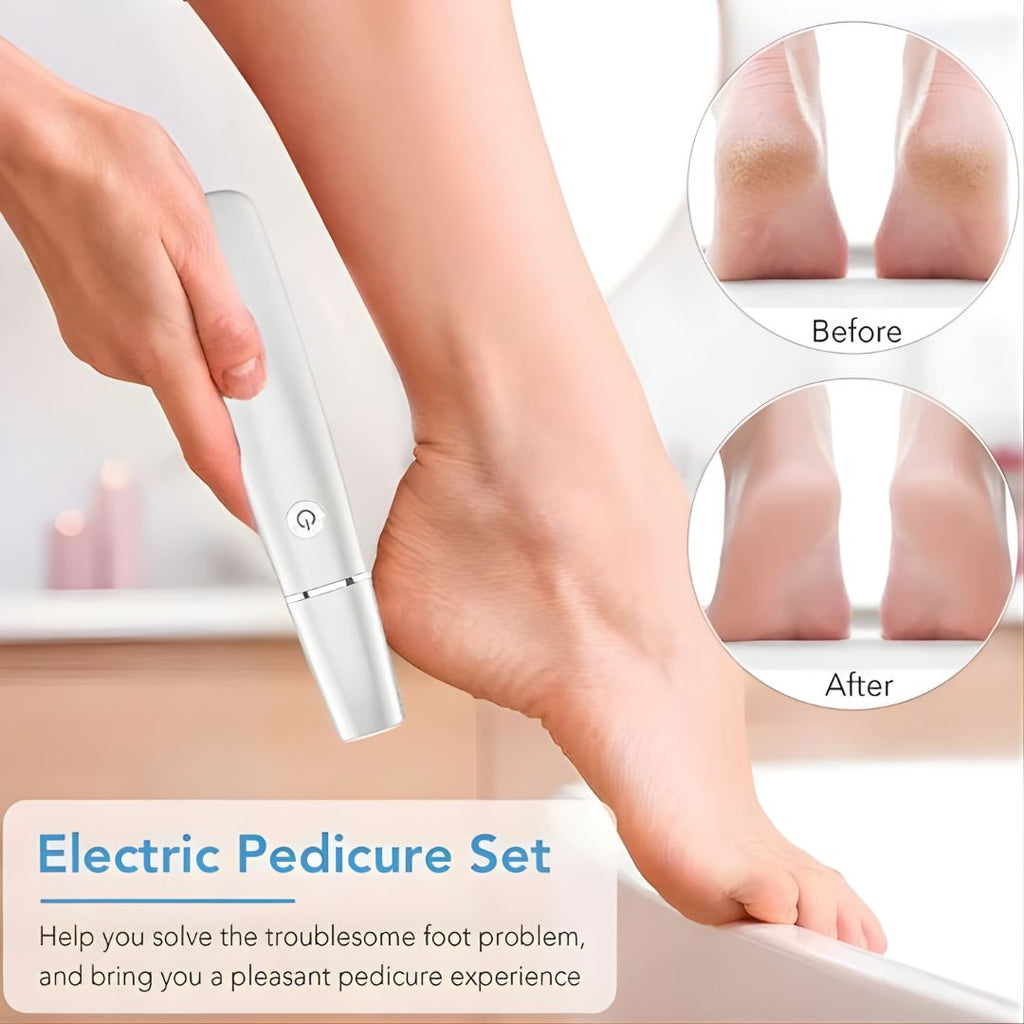 🔥 Buy 1 Get 1 FREE – Electric Foot Callus Remover 👣✨ (UAE Exclusive Offer)