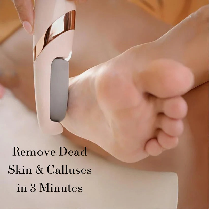 Electric Foot Grinder Pedicure Machine – Remove Dead Skin & Calluses | USB Rechargeable